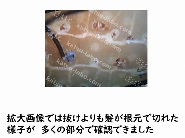 天然人毛が根元から抜けている・切れている状態の拡大写真